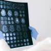 Czy choroba Alzheimera ma podłoże genetyczne?