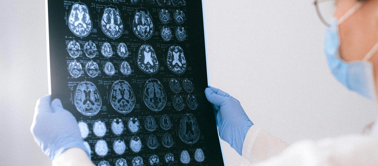 Czy choroba Alzheimera ma podłoże genetyczne?